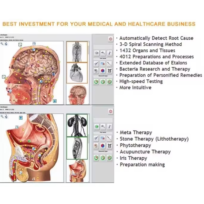Metatron Hunter 4025 NLS Biore – Holistic Health & Wellness Bewertung und Preis