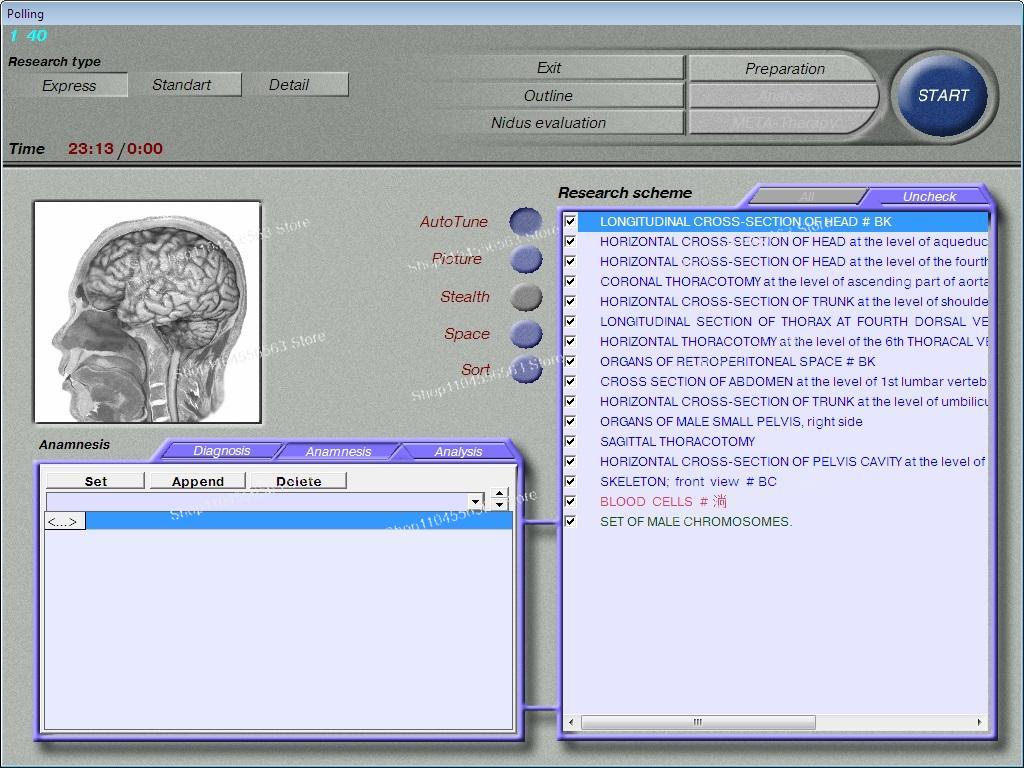 3D NLS Bioresonanz-Scanner & Q – Holistic Health & Wellness Bewertung und Preis
